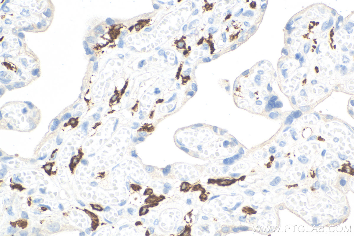 Immunohistochemistry (IHC) staining of human placenta tissue using CD206 Recombinant antibody (81525-1-RR)