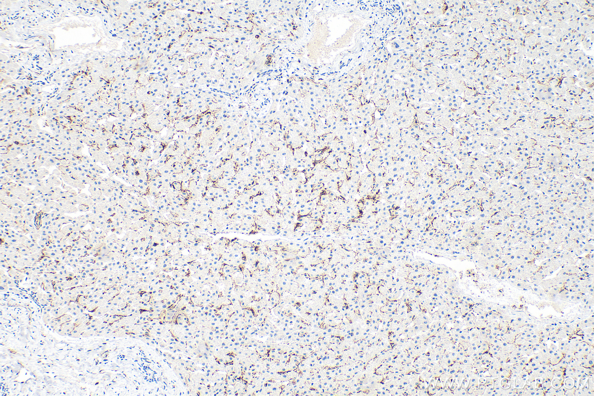Immunohistochemistry (IHC) staining of human liver tissue using CD206 Recombinant monoclonal antibody (81525-1-RR)