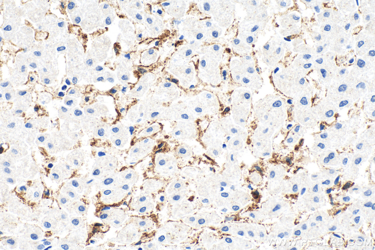 Immunohistochemistry (IHC) staining of human liver tissue using CD206 Recombinant monoclonal antibody (81525-1-RR)