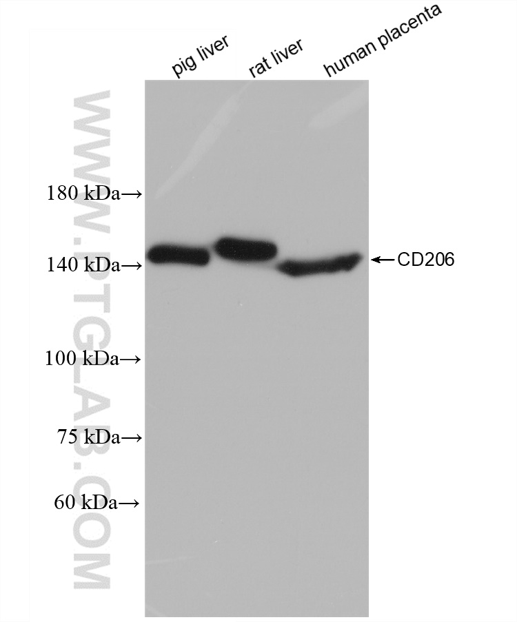 Western Blot (WB) analysis of various lysates using CD206 Recombinant antibody (81525-1-RR)