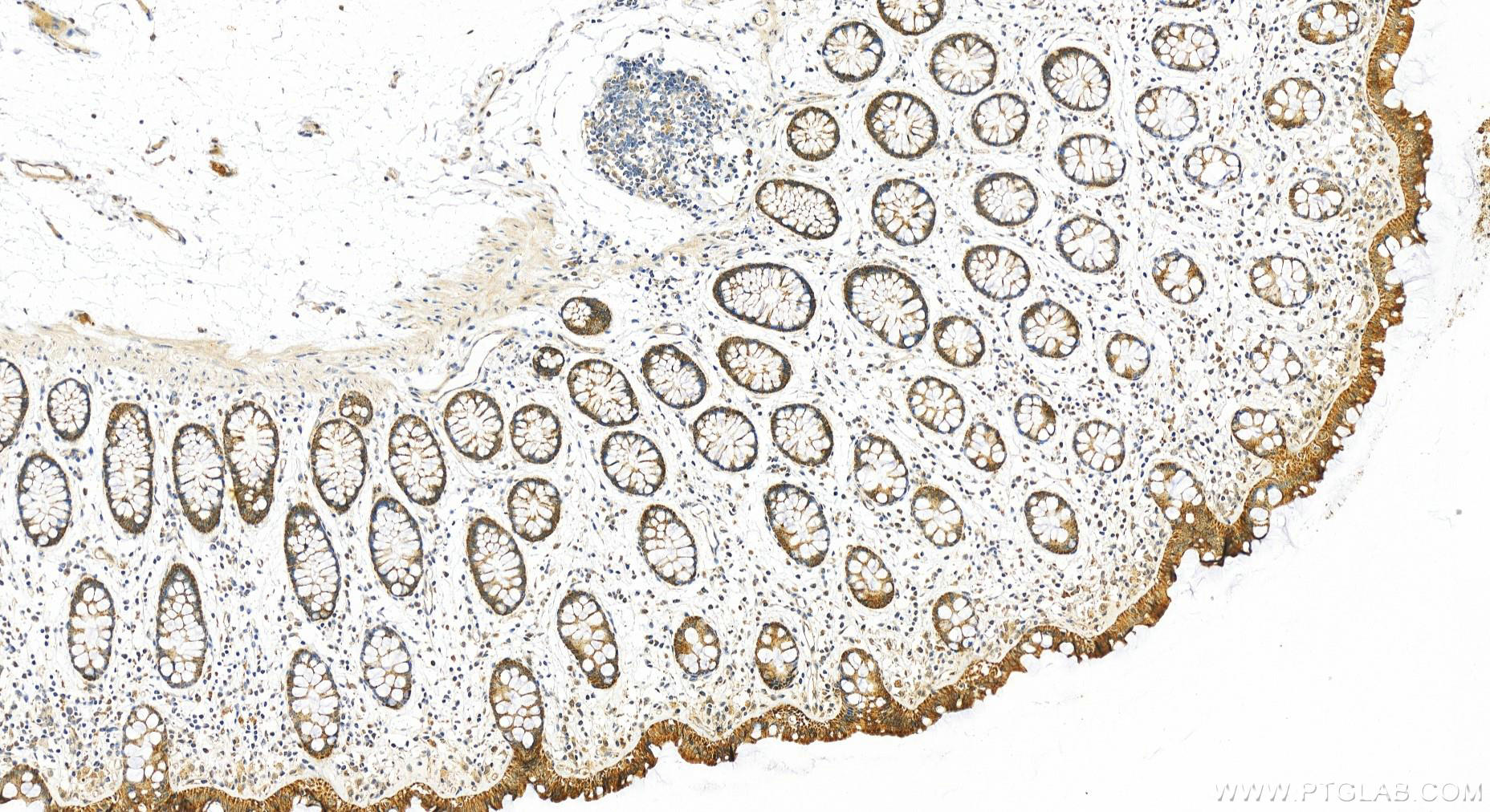 Immunohistochemistry (IHC) staining of human colon tissue using MRP63 Polyclonal antibody (21617-1-AP)