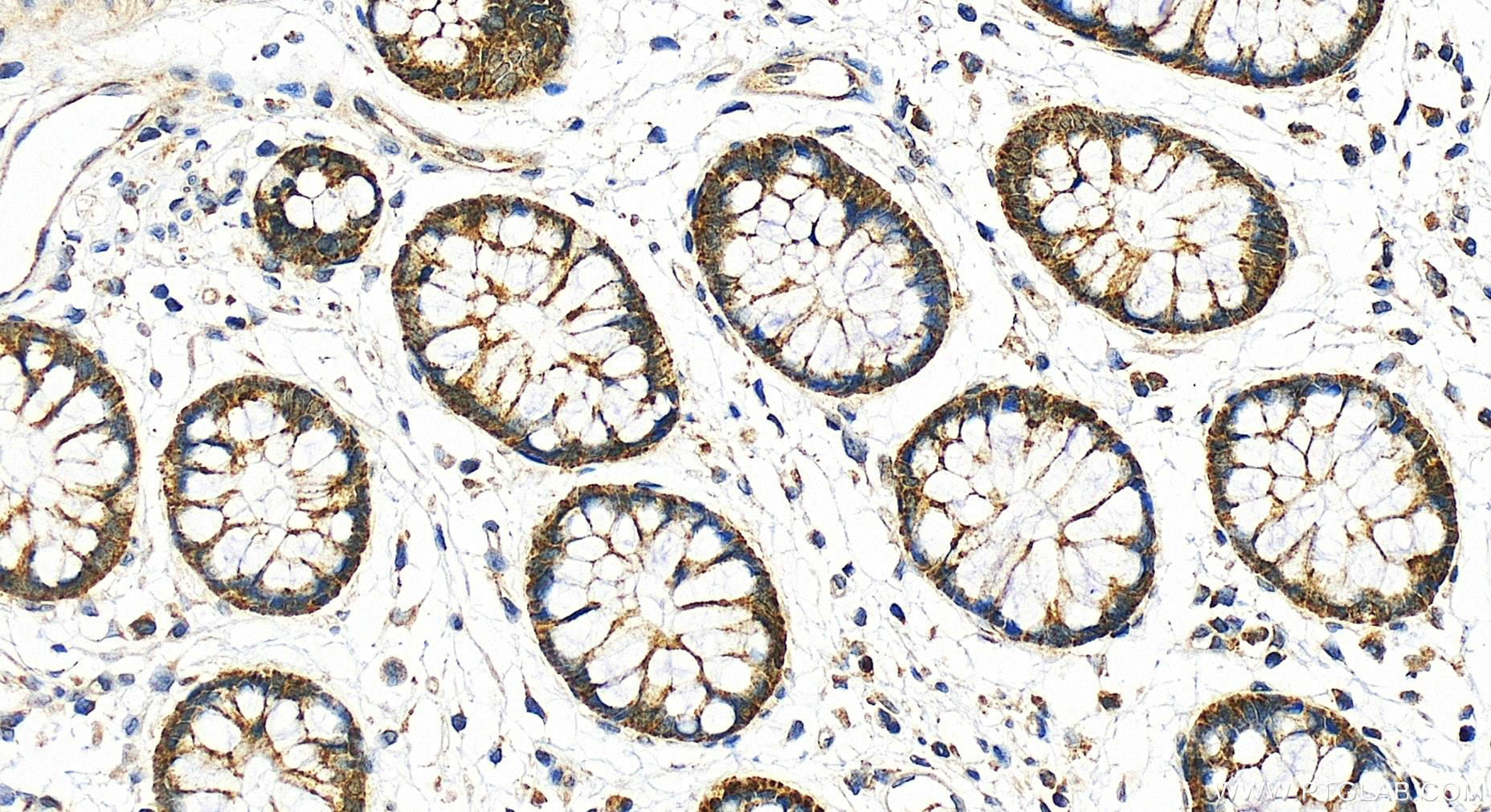 Immunohistochemistry (IHC) staining of human colon tissue using MRP63 Polyclonal antibody (21617-1-AP)