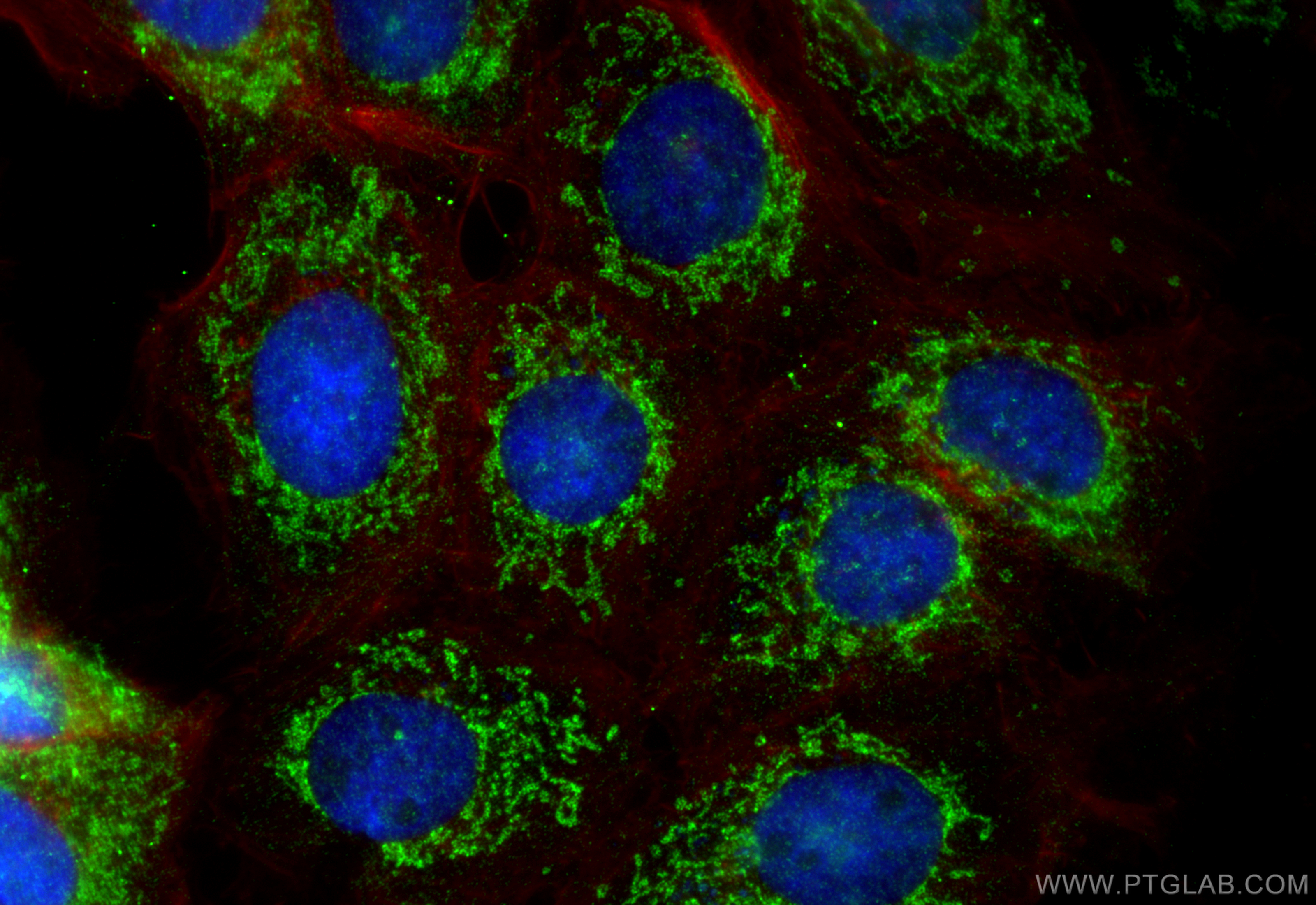 Immunofluorescence (IF) / fluorescent staining of A431 cells using MRPL27 Polyclonal antibody (14765-1-AP)