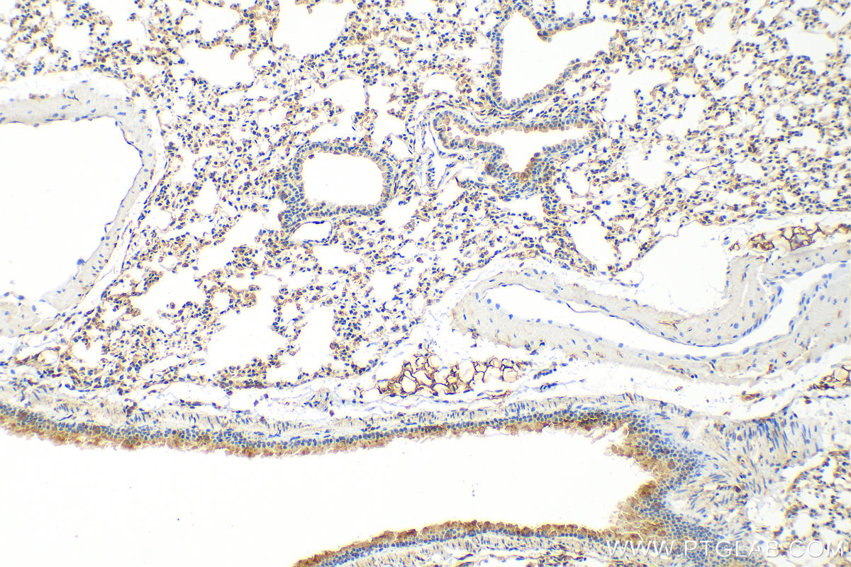 Immunohistochemistry (IHC) staining of mouse lung tissue using MRPL34 Polyclonal antibody (15233-1-AP)