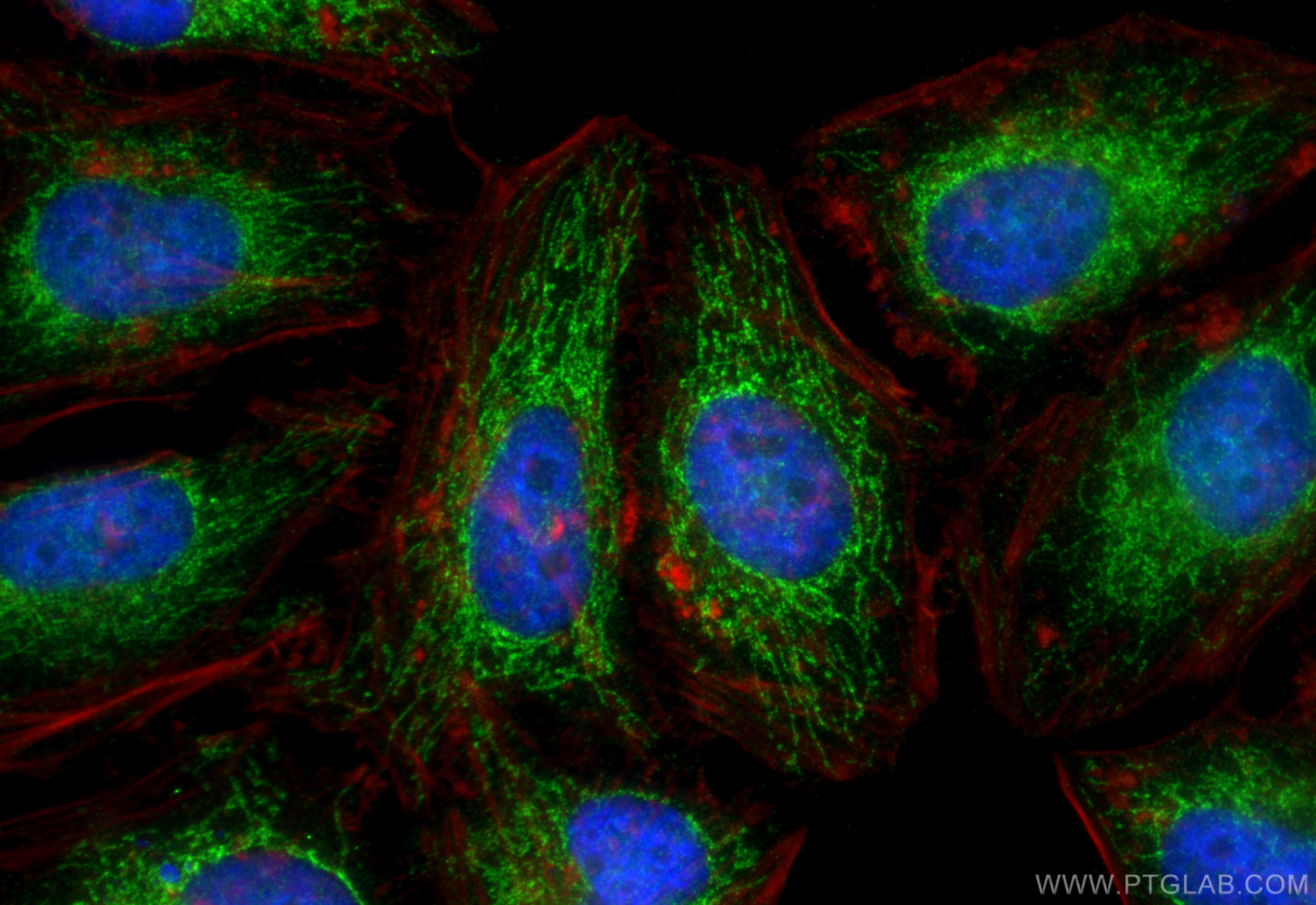 Immunofluorescence (IF) / fluorescent staining of HeLa cells using MRPL40 Polyclonal antibody (16767-1-AP)