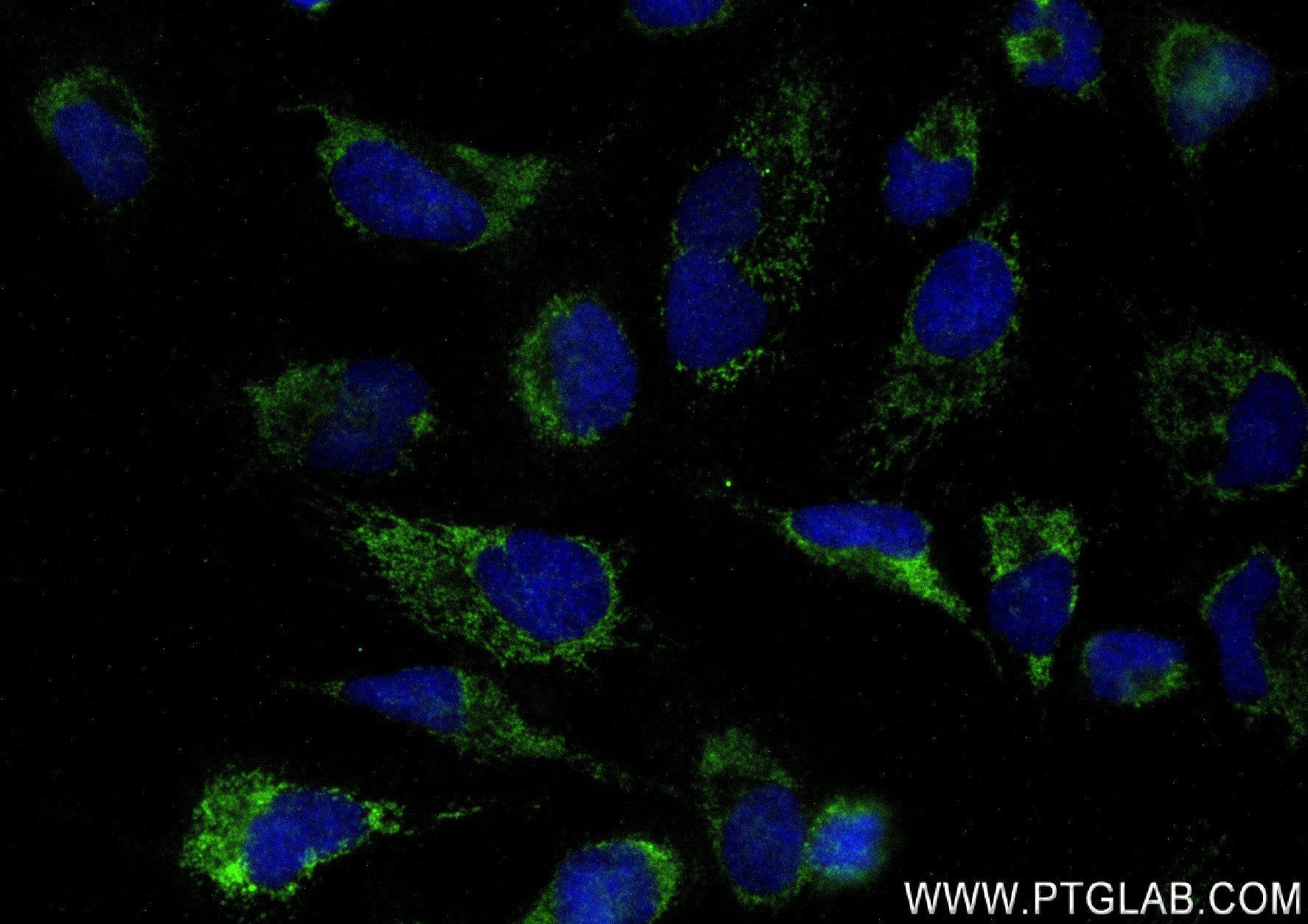 Immunofluorescence (IF) / fluorescent staining of HeLa cells using MRPL40 Recombinant antibody (83515-4-RR)