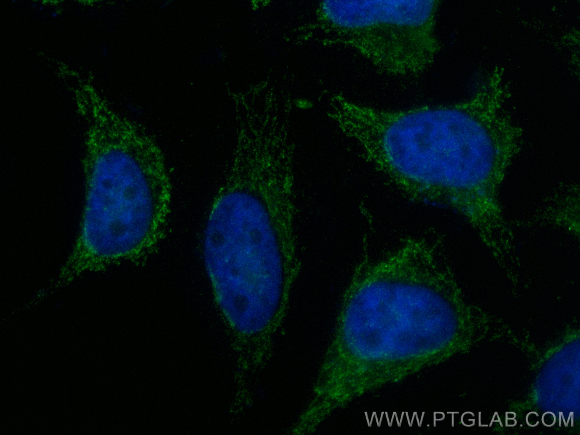 Immunofluorescence (IF) / fluorescent staining of HeLa cells using CoraLite® Plus 488-conjugated MRPL40 Recombinant a (CL488-83515-4)