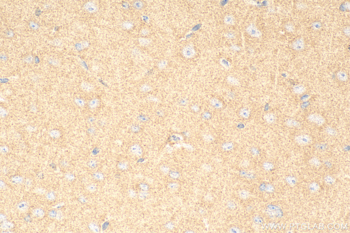 Immunohistochemistry (IHC) staining of mouse brain tissue using MRPL45 Polyclonal antibody (15682-1-AP)