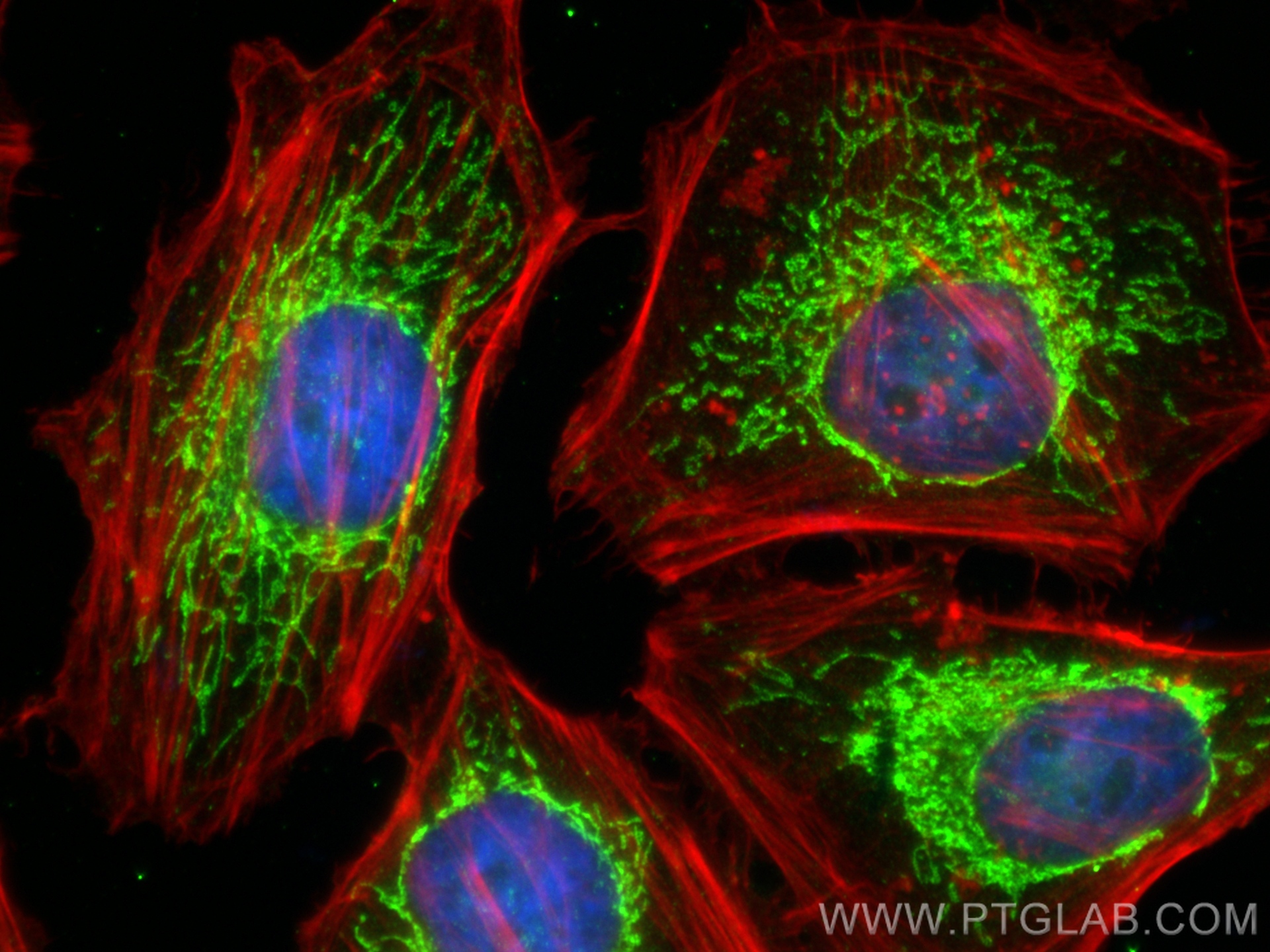 Immunofluorescence (IF) / fluorescent staining of HeLa cells using MRPS15 Polyclonal antibody (17006-1-AP)