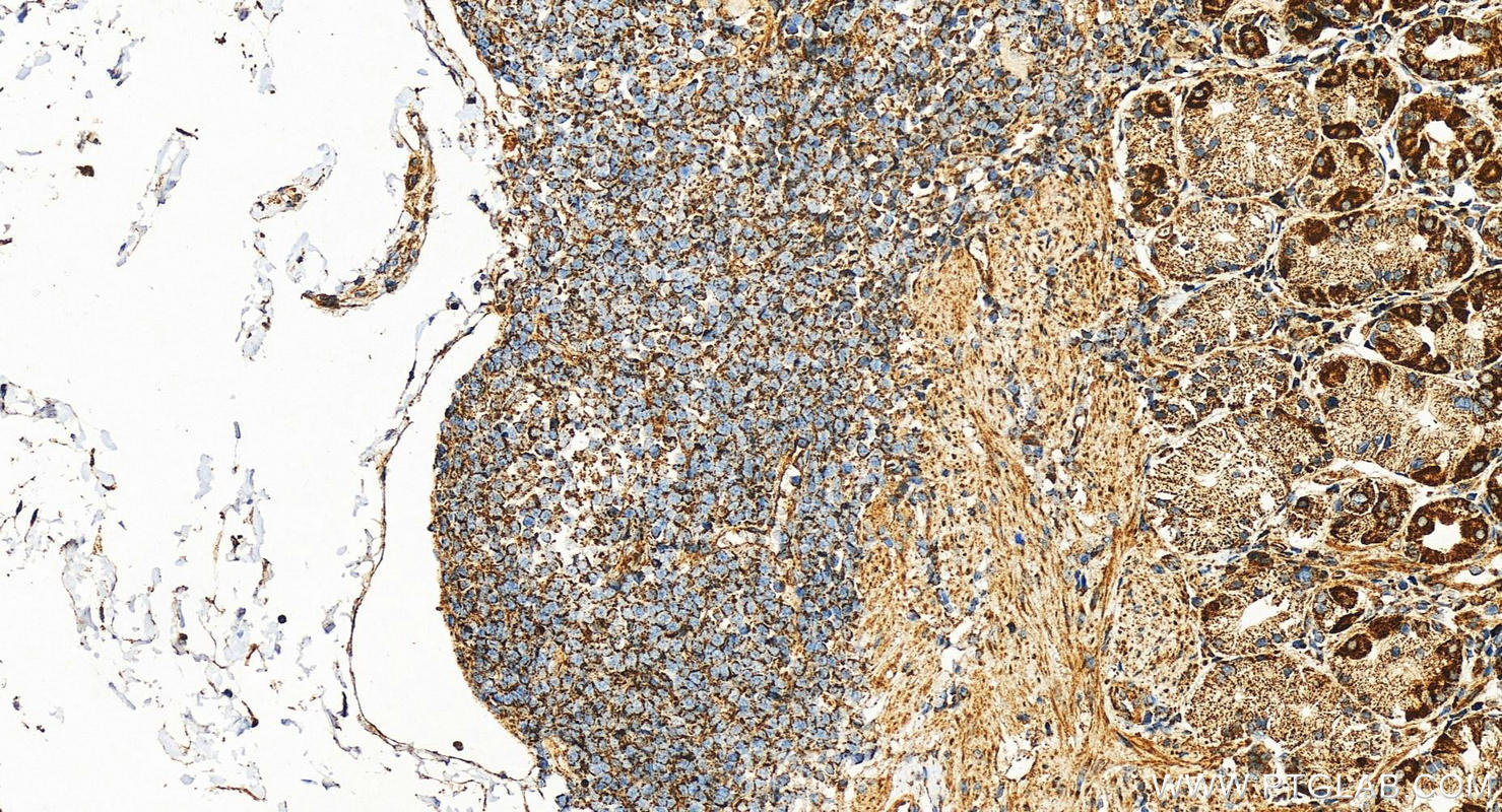 Immunohistochemistry (IHC) staining of human stomach tissue using MRPS18A Polyclonal antibody (16235-1-AP)