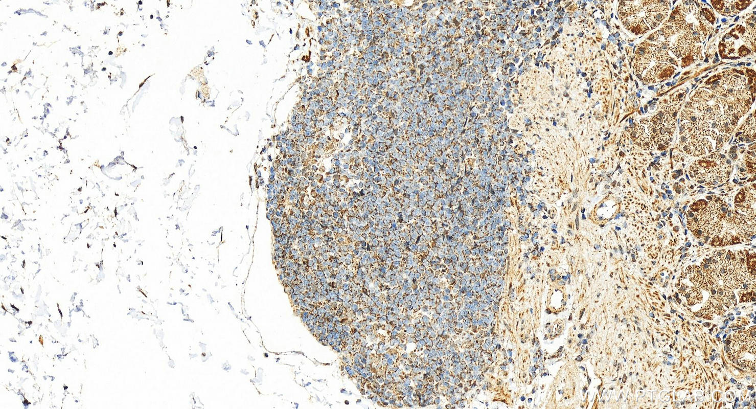 Immunohistochemistry (IHC) staining of human stomach tissue using MRPS24 Polyclonal antibody (16213-1-AP)