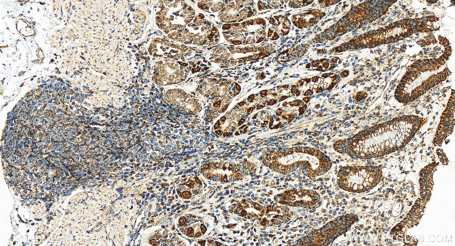 Immunohistochemistry (IHC) staining of human stomach tissue using MRPS25 Polyclonal antibody (15277-1-AP)