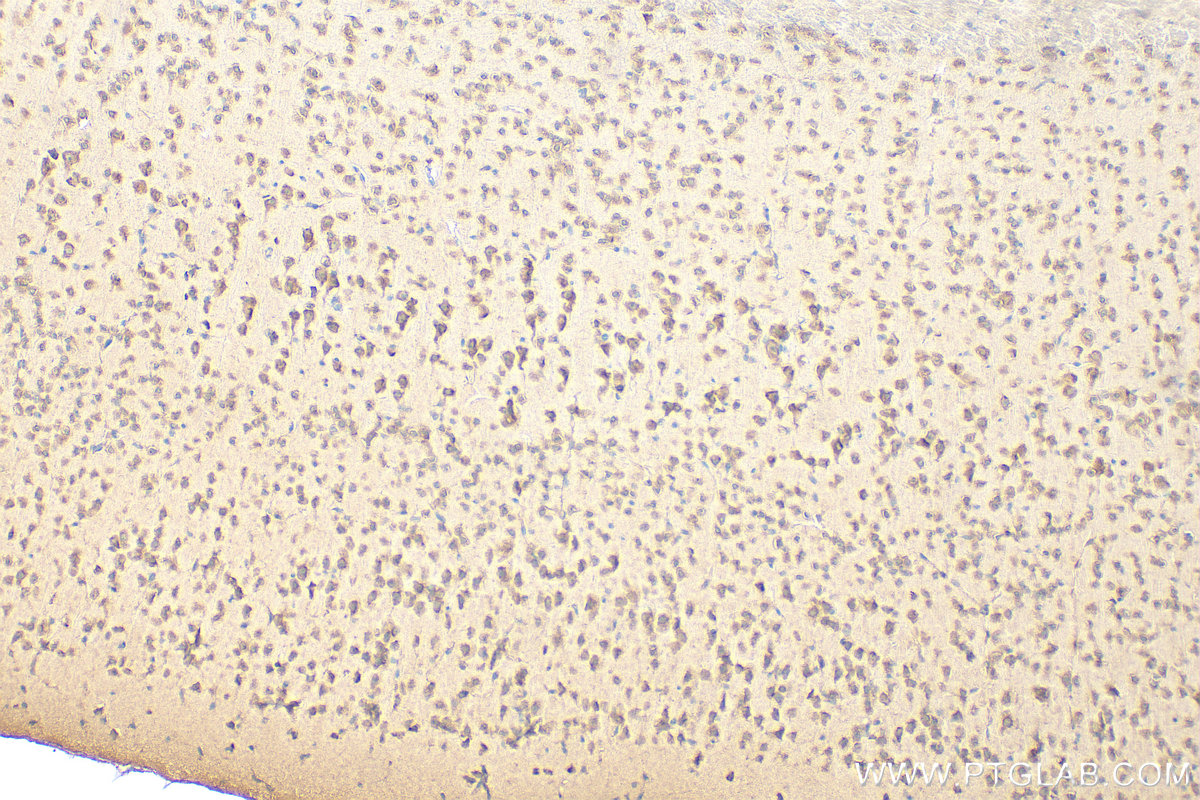 Immunohistochemistry (IHC) staining of mouse brain tissue using MRPS27 Polyclonal antibody (17280-1-AP)