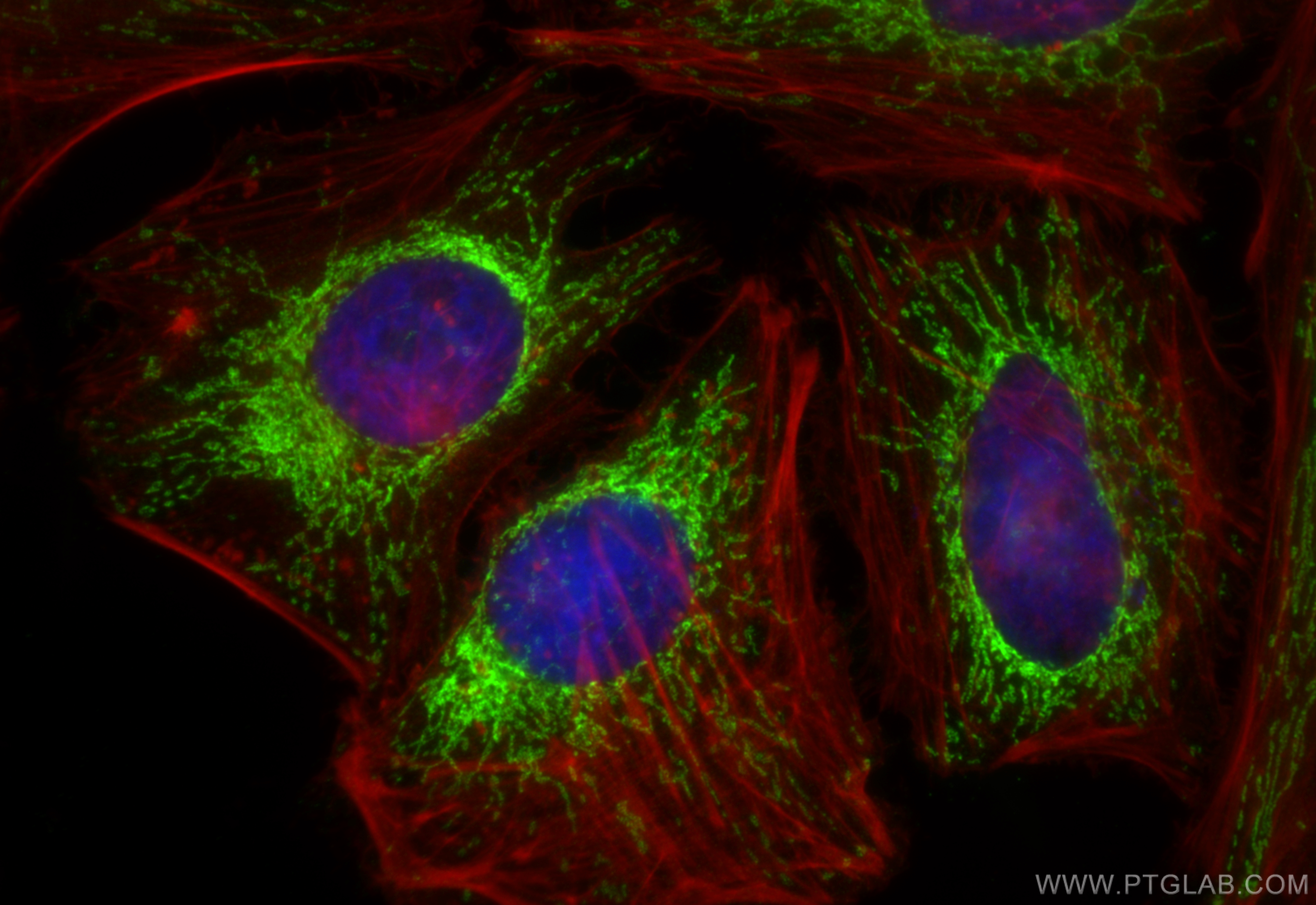 Immunofluorescence (IF) / fluorescent staining of HeLa cells using MRPS28 Polyclonal antibody (16378-1-AP)