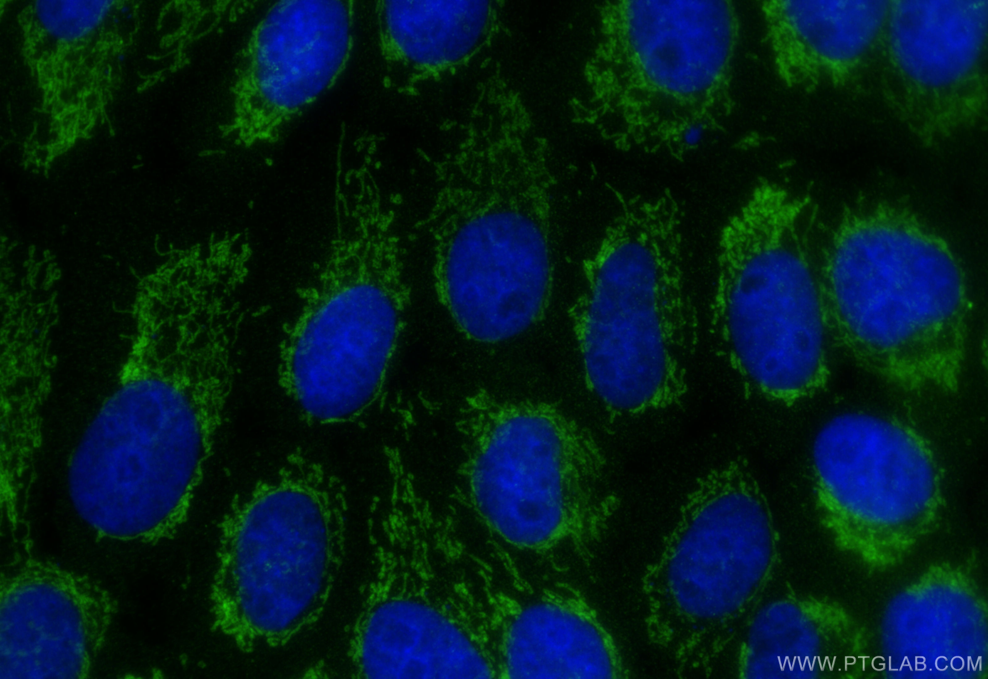 Immunofluorescence (IF) / fluorescent staining of A431 cells using MRRF Polyclonal antibody (12357-2-AP)