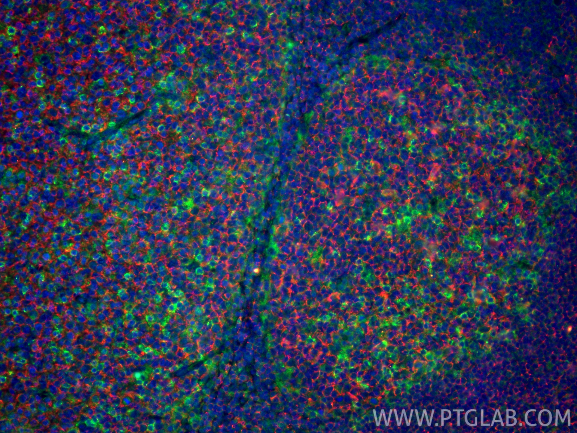 Immunofluorescence (IF) / fluorescent staining of human tonsillitis tissue using CD20 Monoclonal antibody (60271-1-Ig)