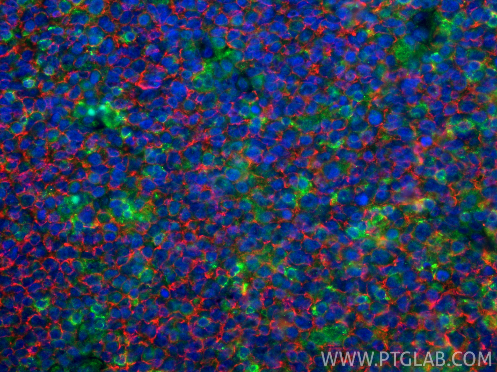 Immunofluorescence (IF) / fluorescent staining of human tonsillitis tissue using CD20 Monoclonal antibody (60271-1-Ig)