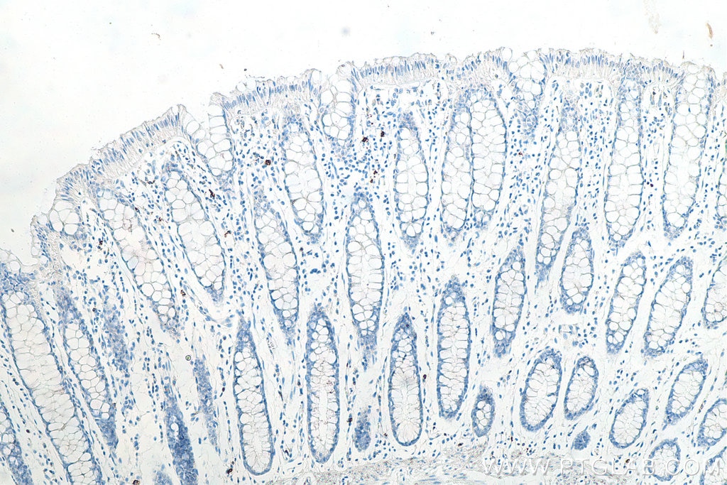 Immunohistochemistry (IHC) staining of human colon tissue using CD20 Monoclonal antibody (60271-1-Ig)
