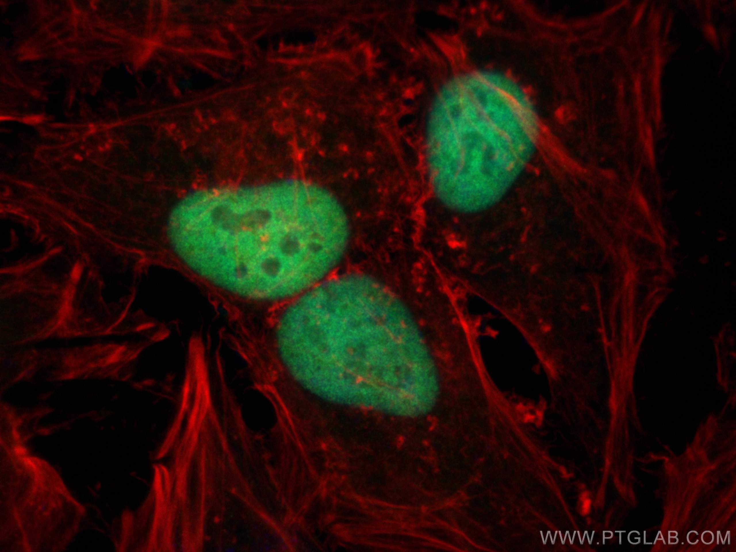 Immunofluorescence (IF) / fluorescent staining of HeLa cells using MSH2 Polyclonal antibody (15520-1-AP)