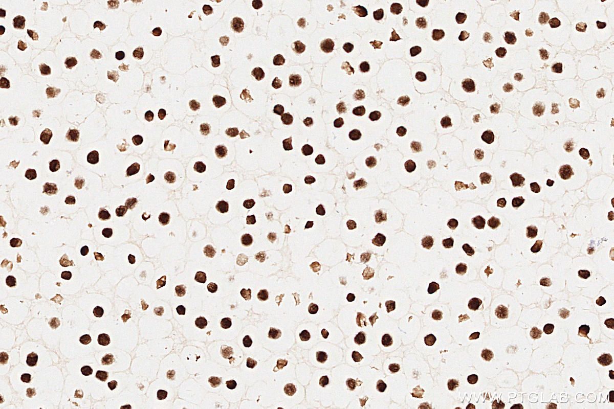 Immunohistochemistry (IHC) staining of Ramos cells using MSH2 Monoclonal antibody (60161-1-Ig)