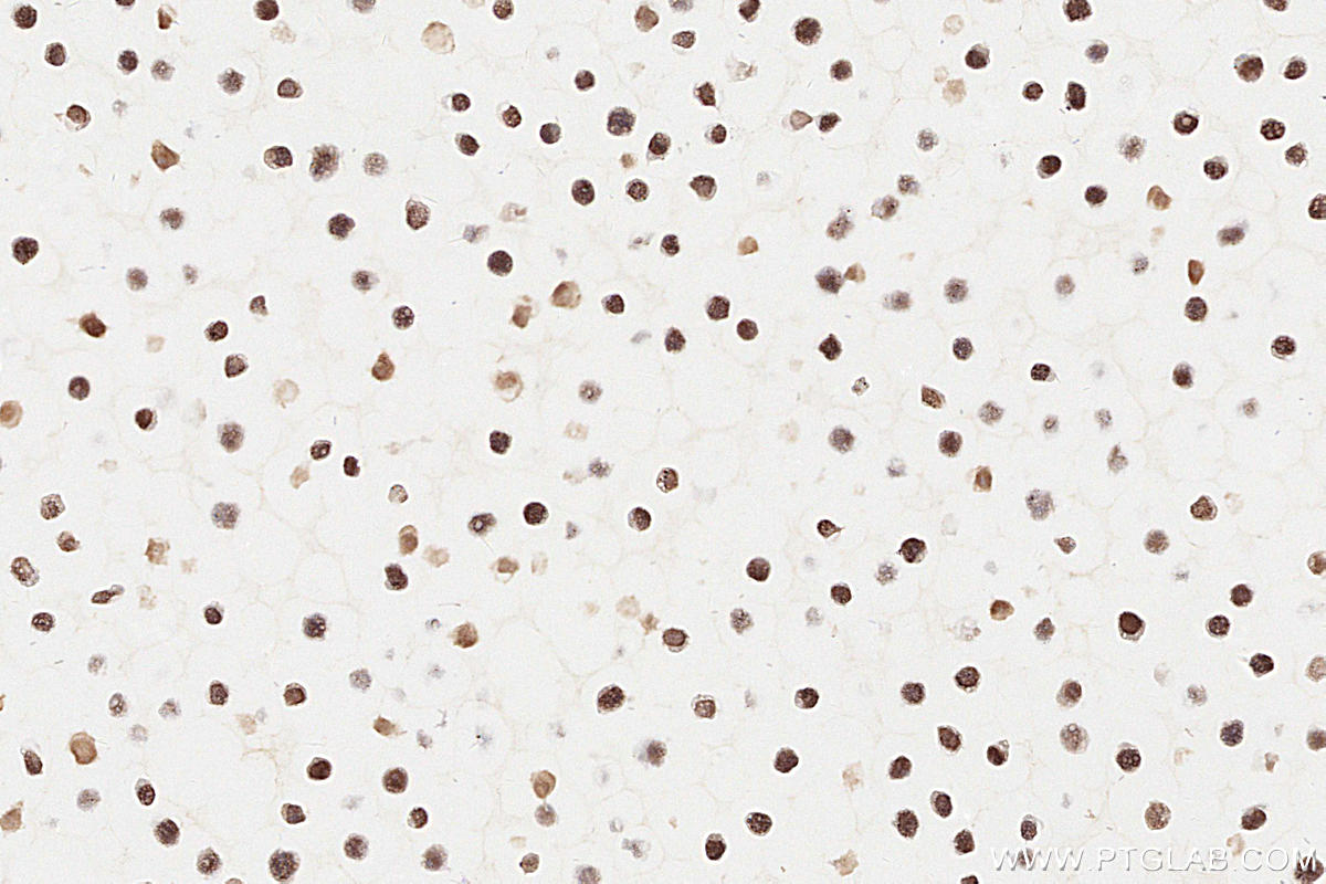 Immunohistochemistry (IHC) staining of Ramos cells using MSH2 Monoclonal antibody (60161-2-Ig)