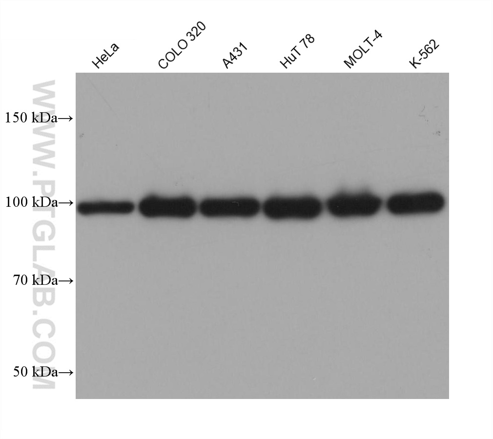 Western Blot (WB) analysis of various lysates using MSH2 Monoclonal antibody (60161-2-Ig)