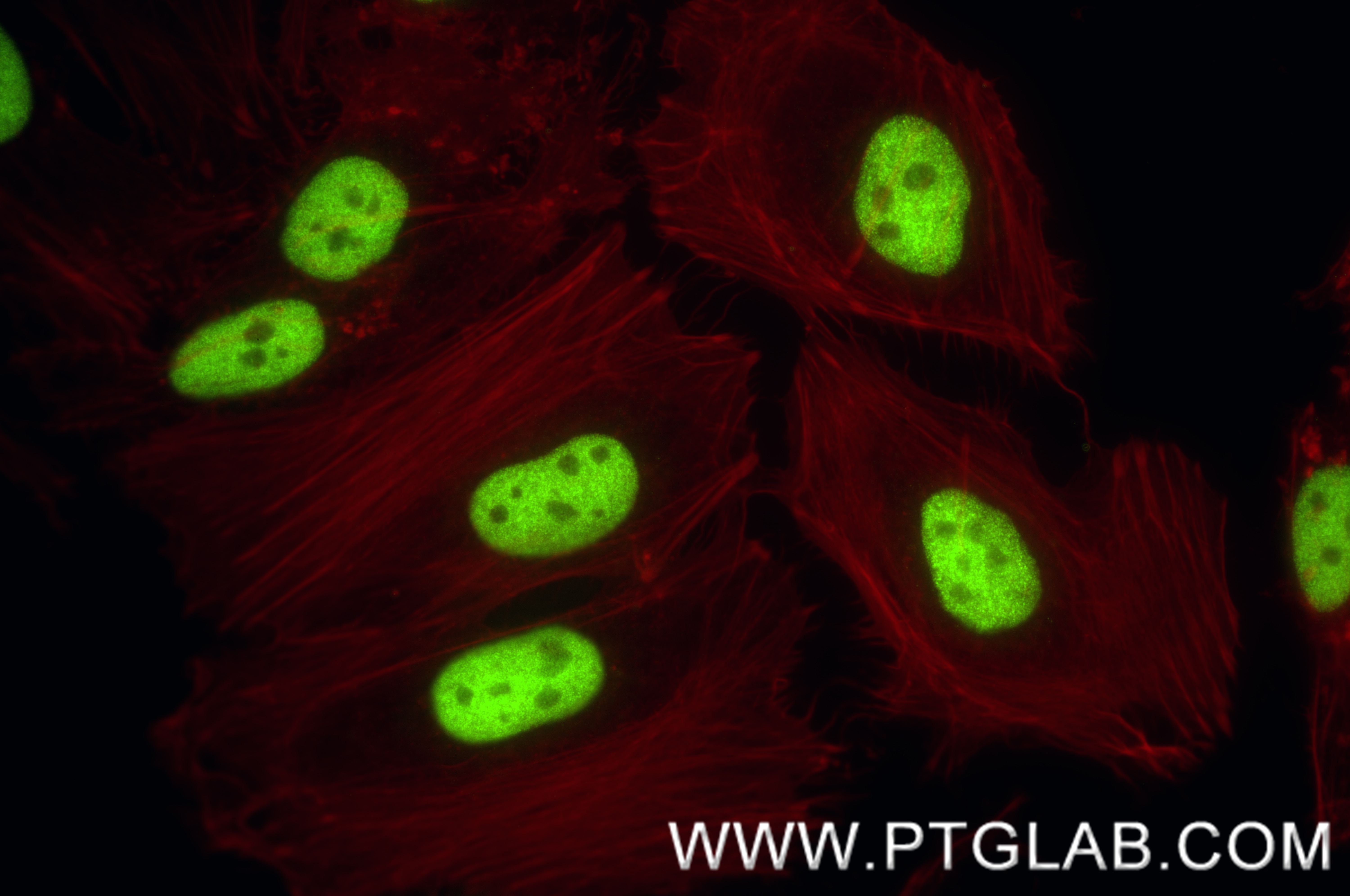 Immunofluorescence (IF) / fluorescent staining of HeLa cells using MSH2 Recombinant monoclonal antibody (82775-1-RR)