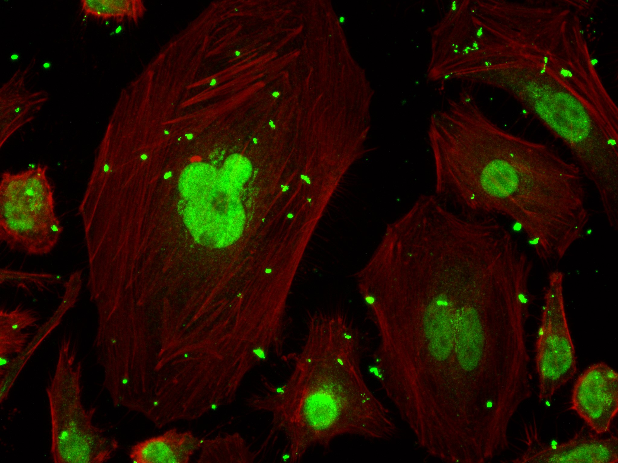 Immunofluorescence (IF) / fluorescent staining of HeLa cells using MSH3 Recombinant antibody, PBS Only (82845-3-PBS)