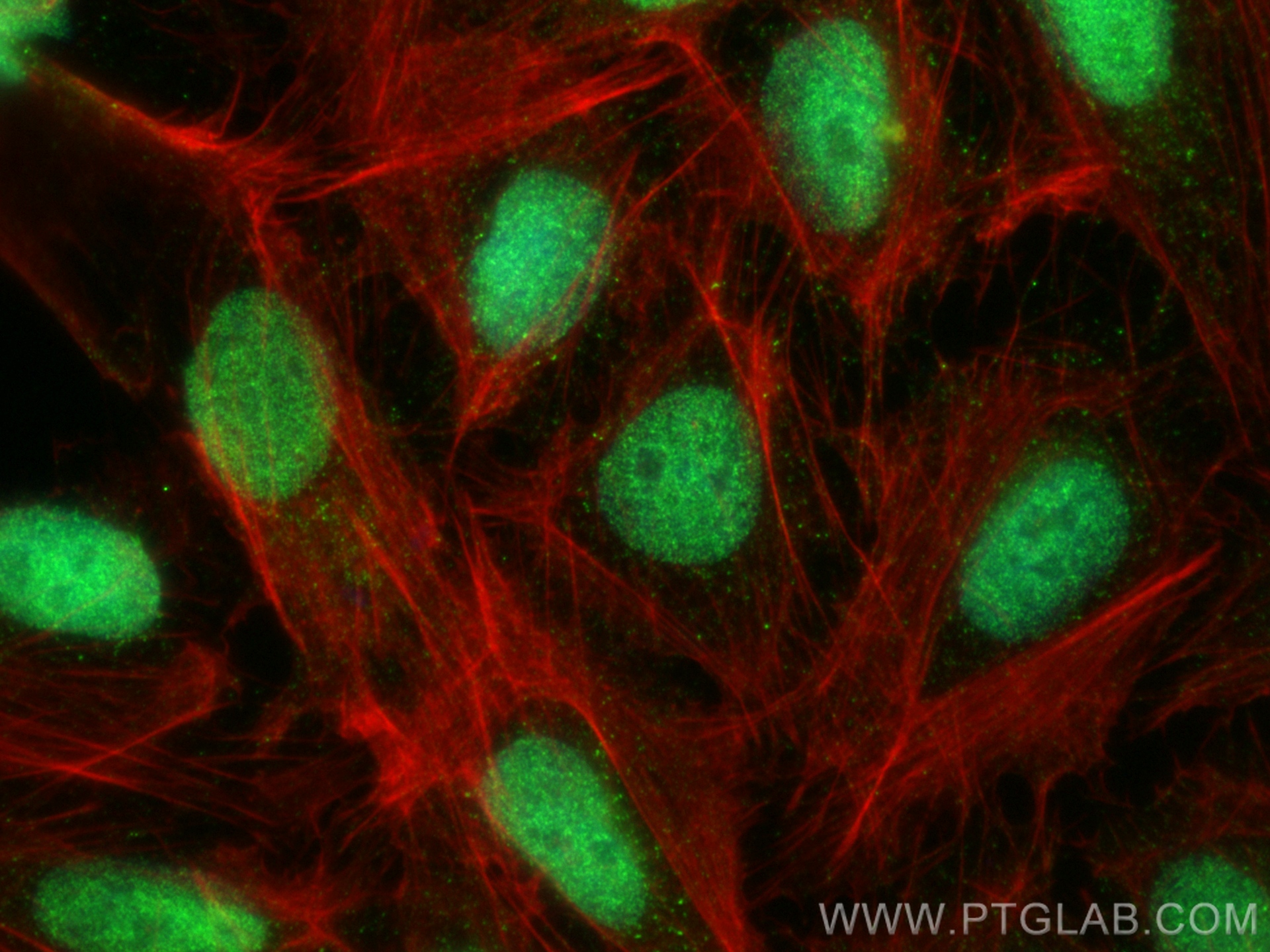 Immunofluorescence (IF) / fluorescent staining of U2OS cells using MSH3 Recombinant antibody (82845-3-RR)