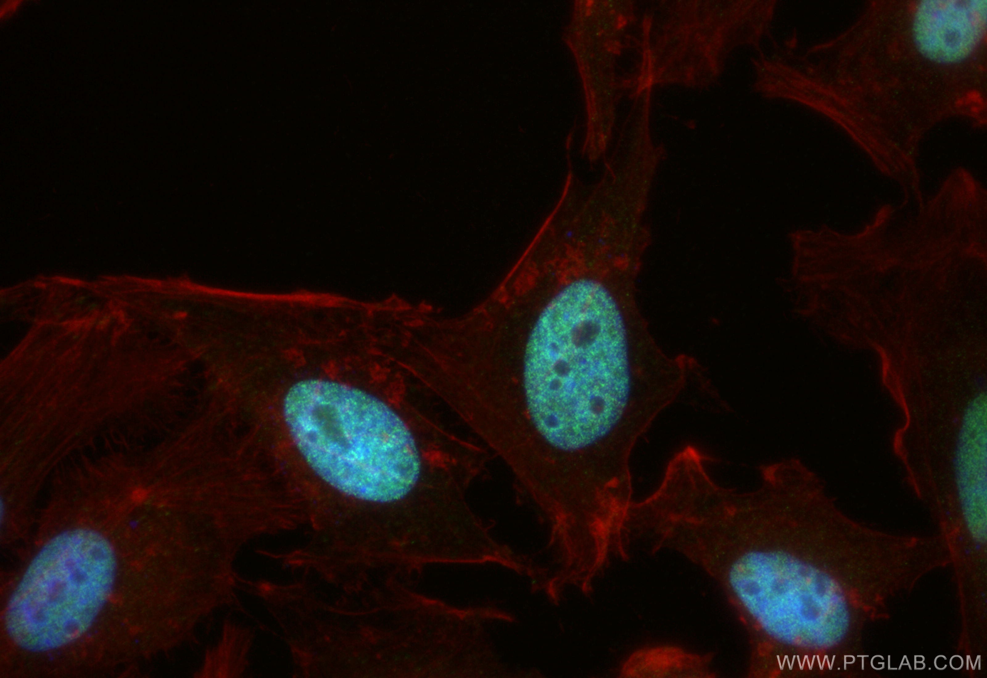 Immunofluorescence (IF) / fluorescent staining of HeLa cells using MSH6 Polyclonal antibody (18120-1-AP)