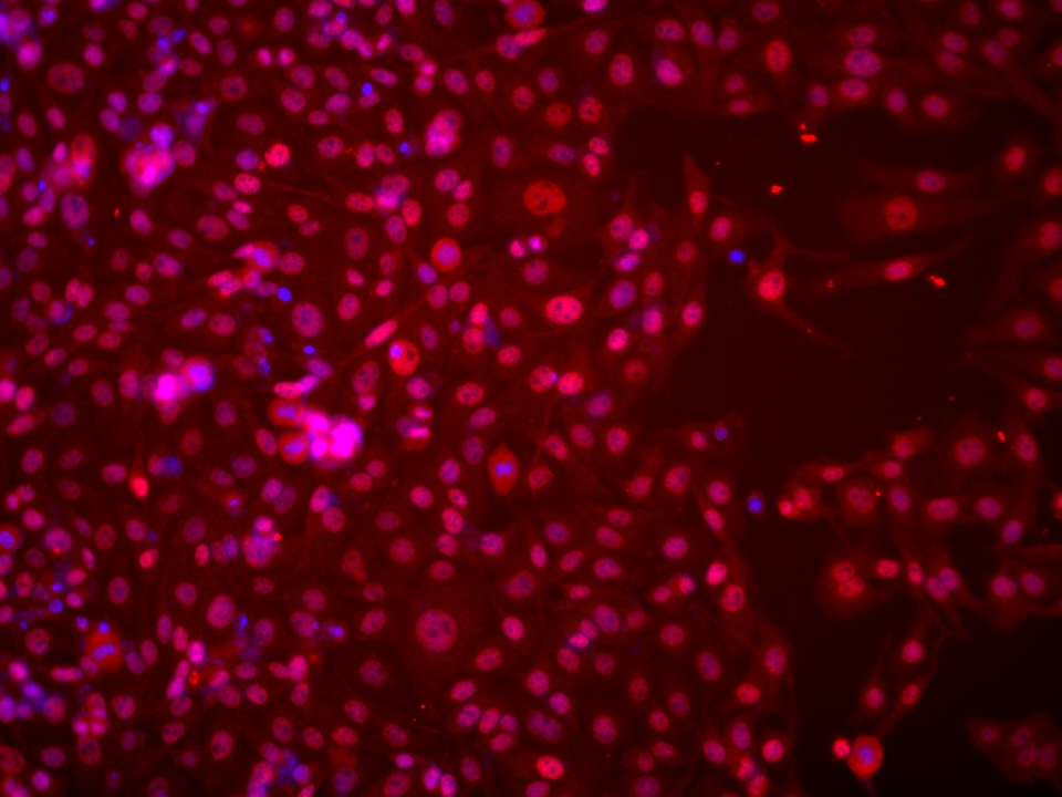 Immunofluorescence (IF) / fluorescent staining of U2OS cells using MSH6 Monoclonal antibody (66172-1-Ig)