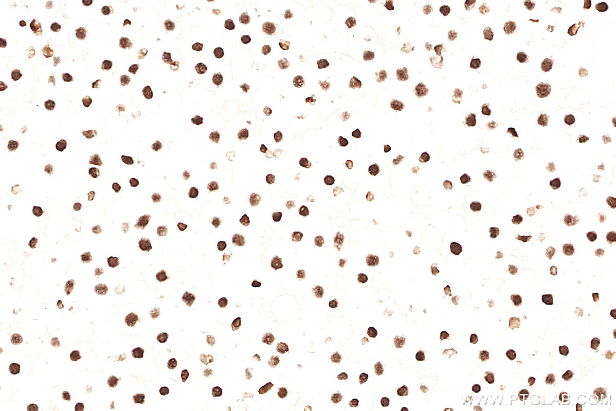 Immunohistochemistry (IHC) staining of Ramos cells using MSH6 Monoclonal antibody (66172-1-Ig)