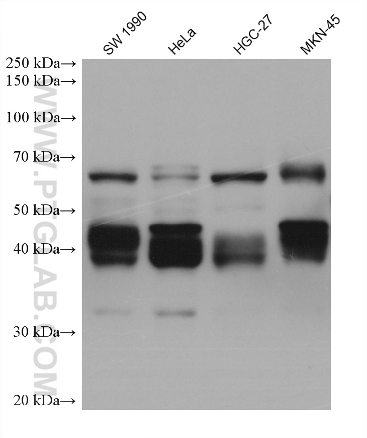 Western Blot (WB) analysis of various lysates using Mesothelin Monoclonal antibody (66404-1-Ig)