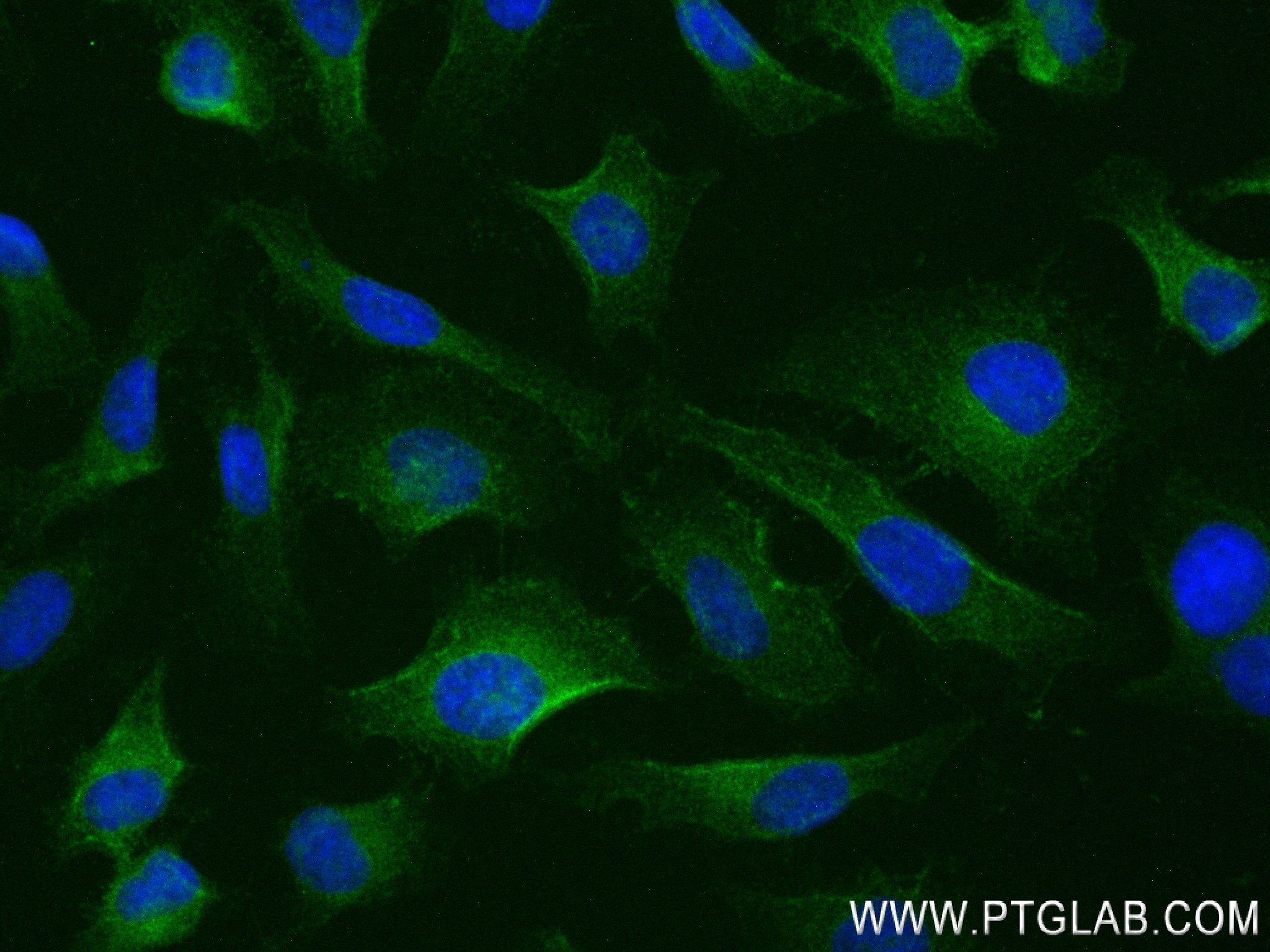 Immunofluorescence (IF) / fluorescent staining of HeLa cells using MSLN Recombinant antibody (83744-2-RR)