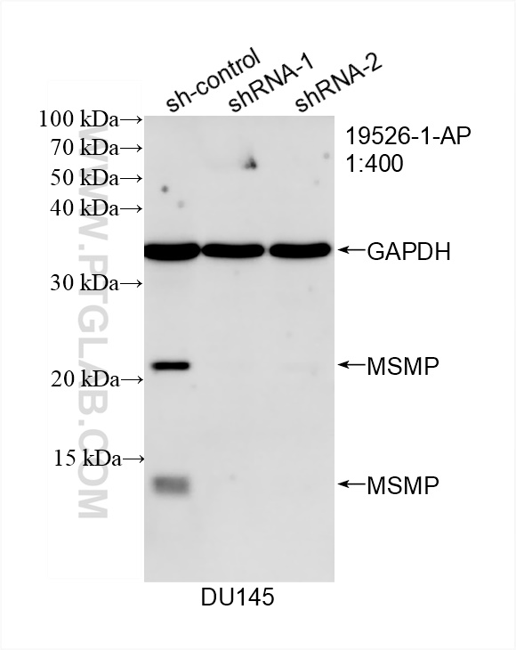 Western Blot (WB) analysis of DU 145 cells using MSMP Polyclonal antibody (19526-1-AP)