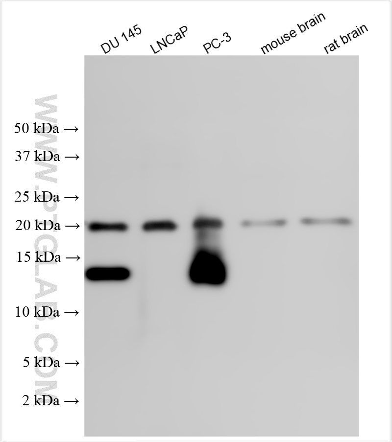 Western Blot (WB) analysis of various lysates using MSMP Polyclonal antibody (19526-1-AP)