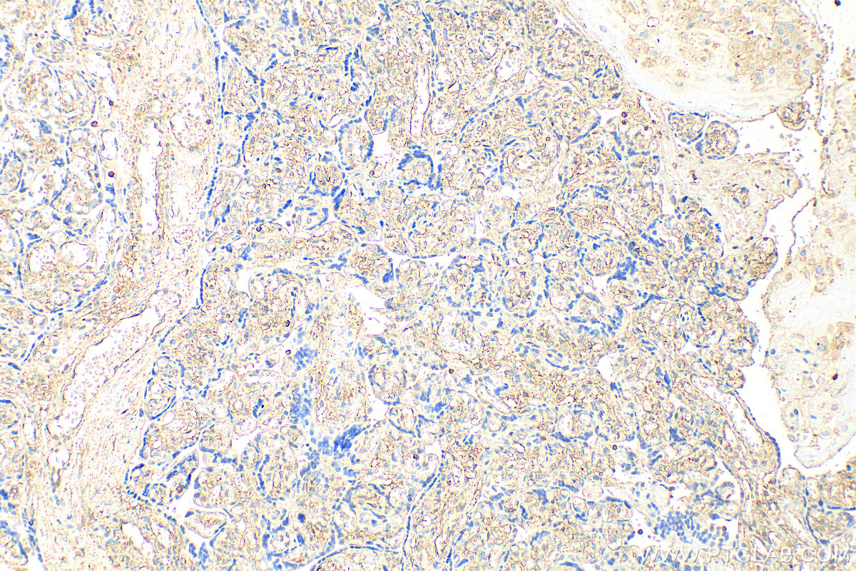 Immunohistochemistry (IHC) staining of human placenta tissue using Moesin Polyclonal antibody (16495-1-AP)