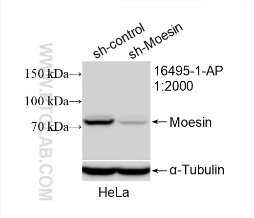 Western Blot (WB) analysis of HeLa cells using Moesin Polyclonal antibody (16495-1-AP)
