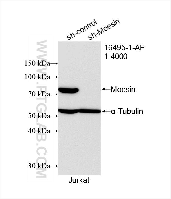 Western Blot (WB) analysis of Jurkat cells using Moesin Polyclonal antibody (16495-1-AP)
