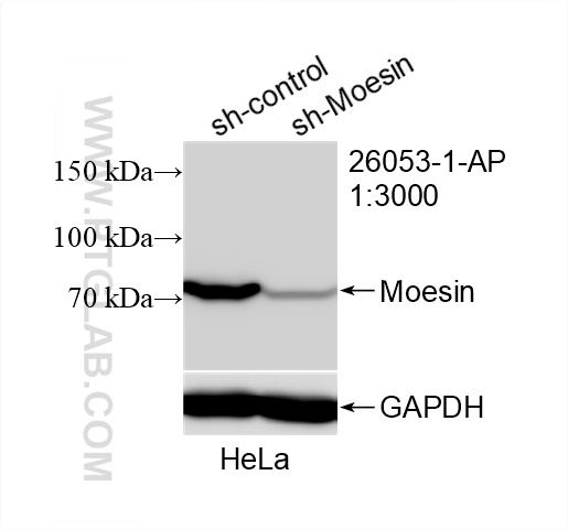 Western Blot (WB) analysis of HeLa cells using Moesin Polyclonal antibody (26053-1-AP)