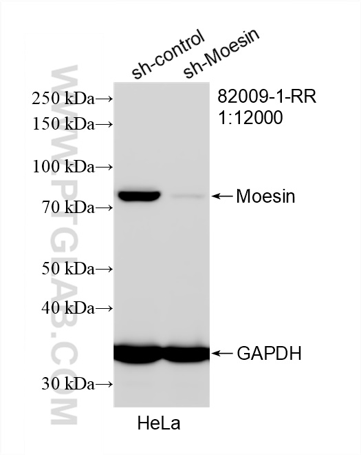 Western Blot (WB) analysis of HeLa cells using Moesin Recombinant antibody (82009-1-RR)