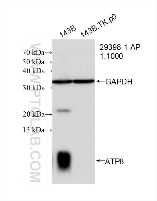 Western Blot (WB) analysis of 143B.TK.P0 cells using ATP8 Polyclonal antibody (29398-1-AP)