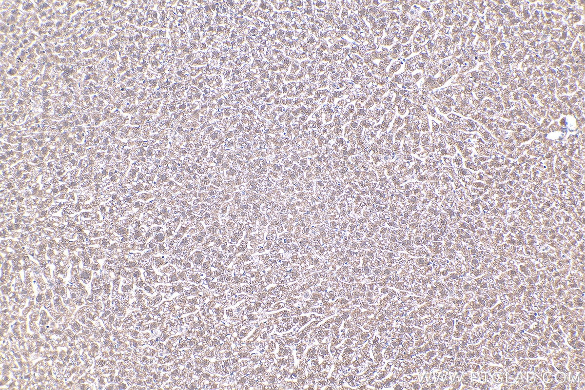 Immunohistochemistry (IHC) staining of mouse liver tissue using MT2A Polyclonal antibody (20809-1-AP)