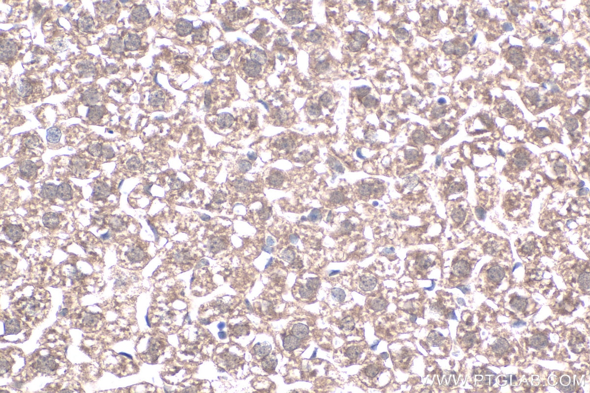 Immunohistochemistry (IHC) staining of mouse liver tissue using MT2A Polyclonal antibody (20809-1-AP)