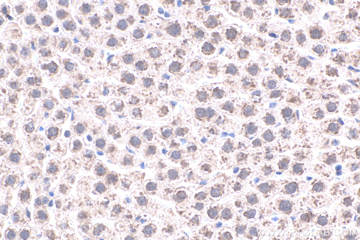 Immunohistochemistry (IHC) staining of rat liver tissue using MT2A Polyclonal antibody (20809-1-AP)