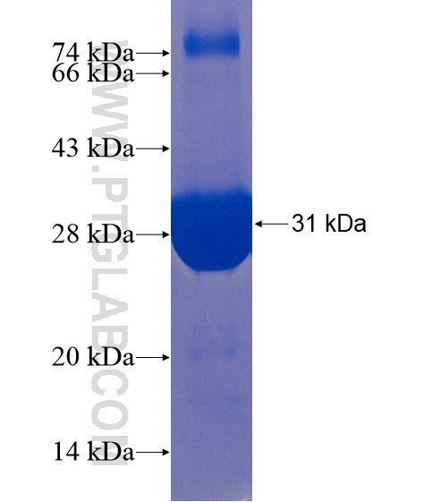 MT4 fusion protein Ag22101 SDS-PAGE