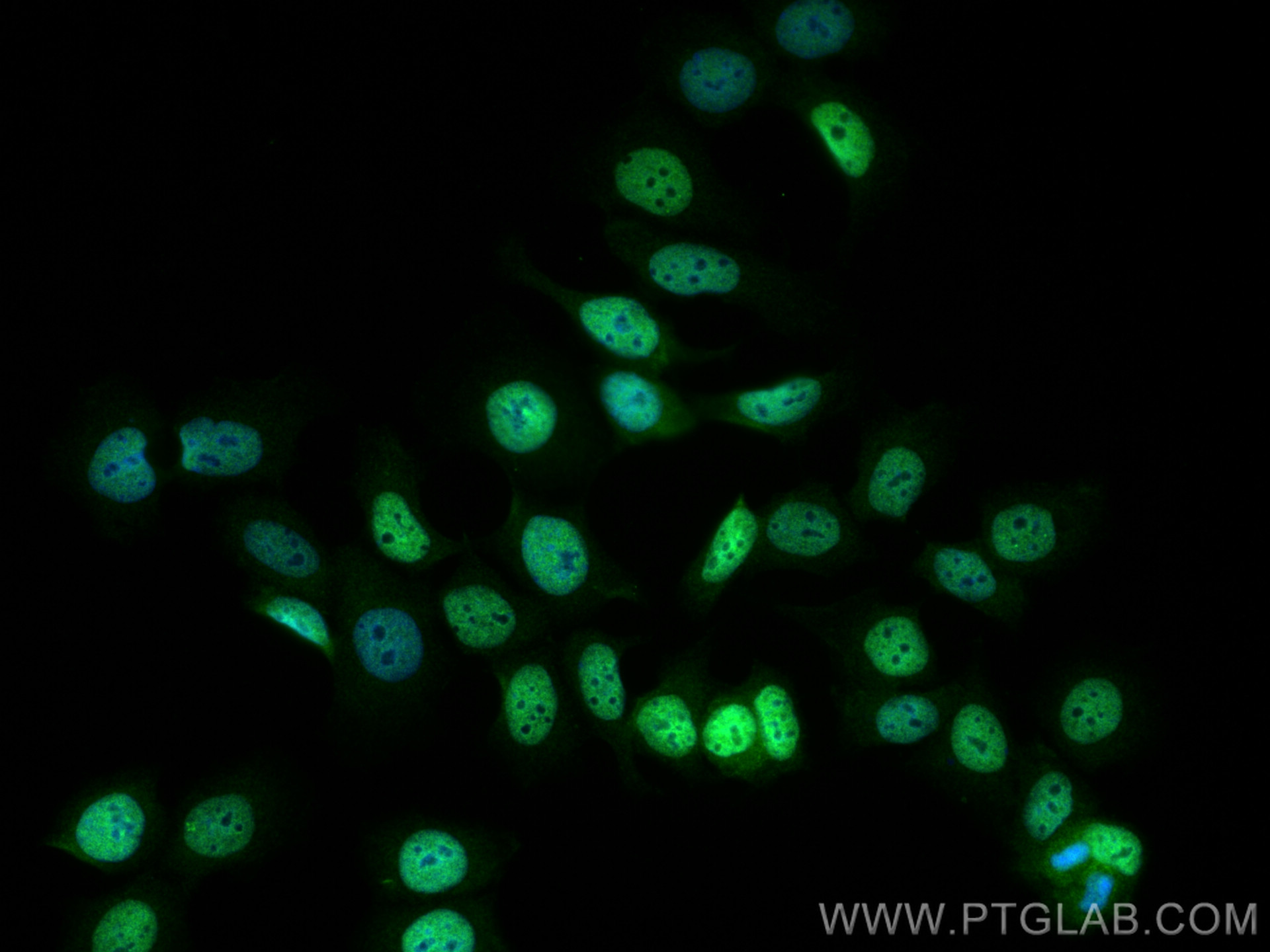 Immunofluorescence (IF) / fluorescent staining of MCF-7 cells using MTA1 Polyclonal antibody (30545-1-AP)