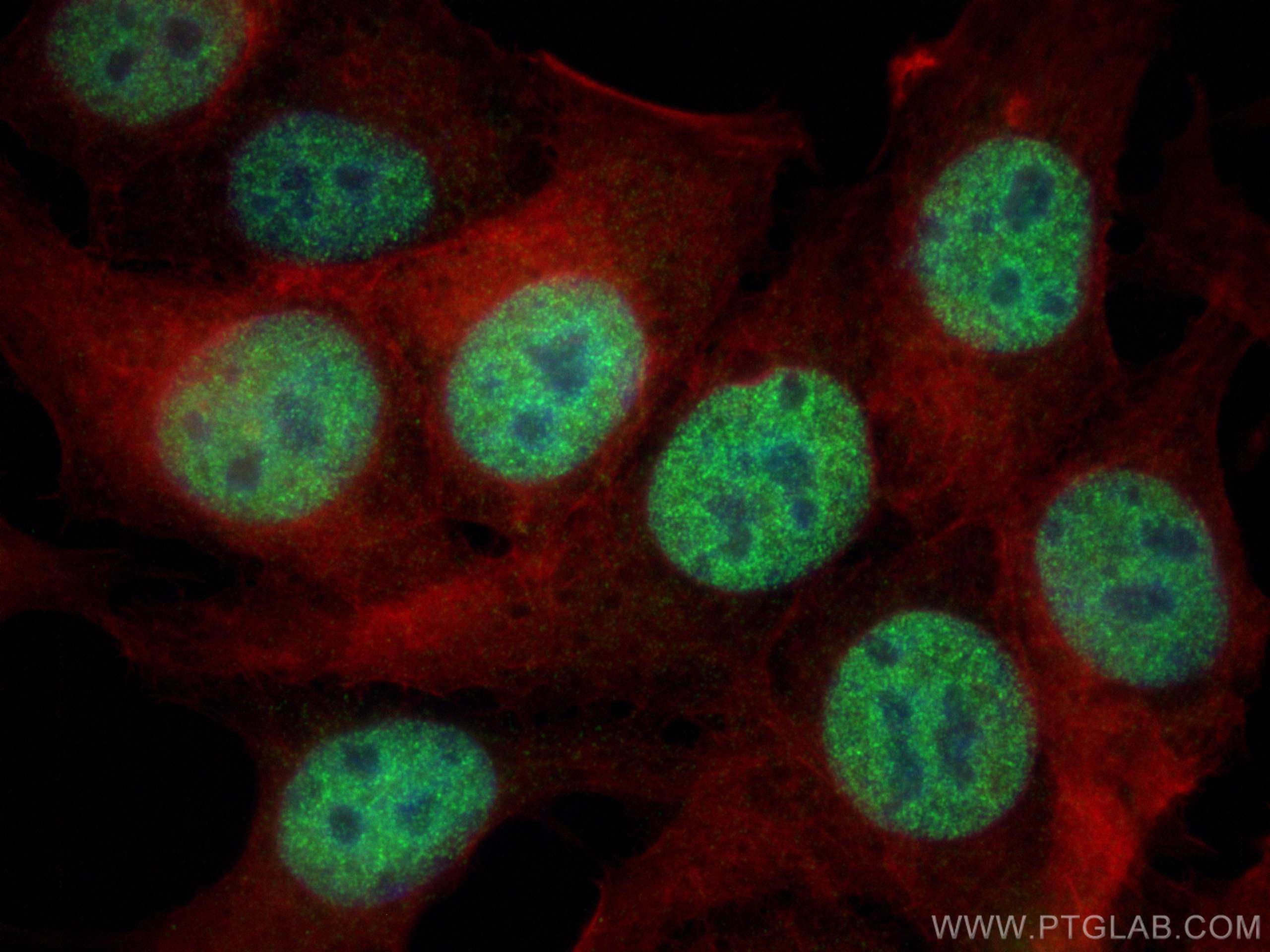 Immunofluorescence (IF) / fluorescent staining of MCF-7 cells using MTA1 Polyclonal antibody (30545-1-AP)