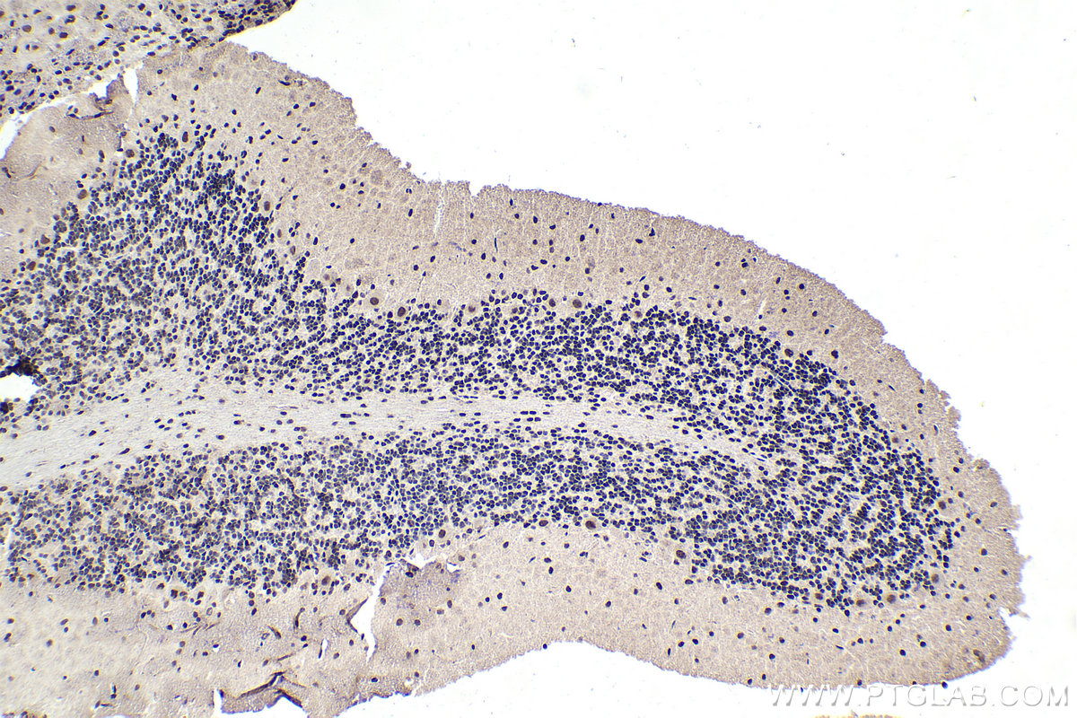 Immunohistochemistry (IHC) staining of rat cerebellum tissue using MTA1 Polyclonal antibody (30545-1-AP)