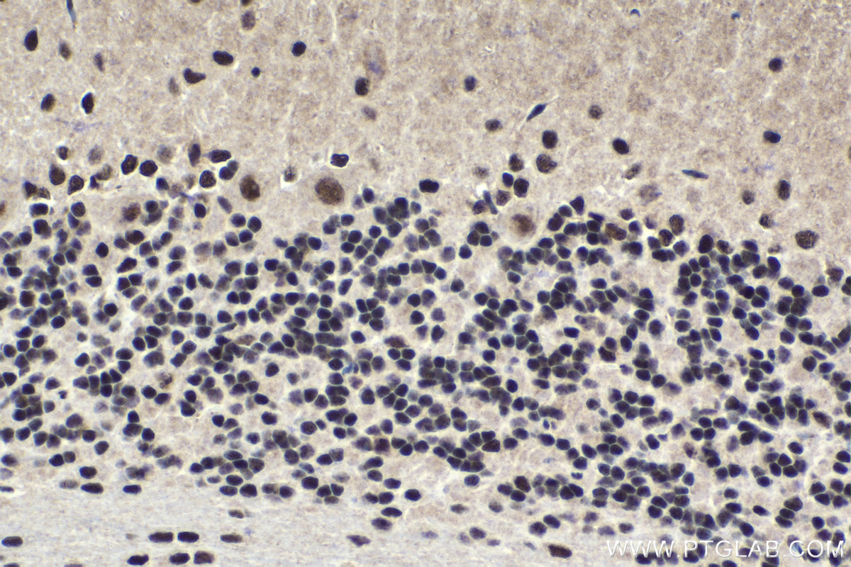 Immunohistochemistry (IHC) staining of rat cerebellum tissue using MTA1 Polyclonal antibody (30545-1-AP)